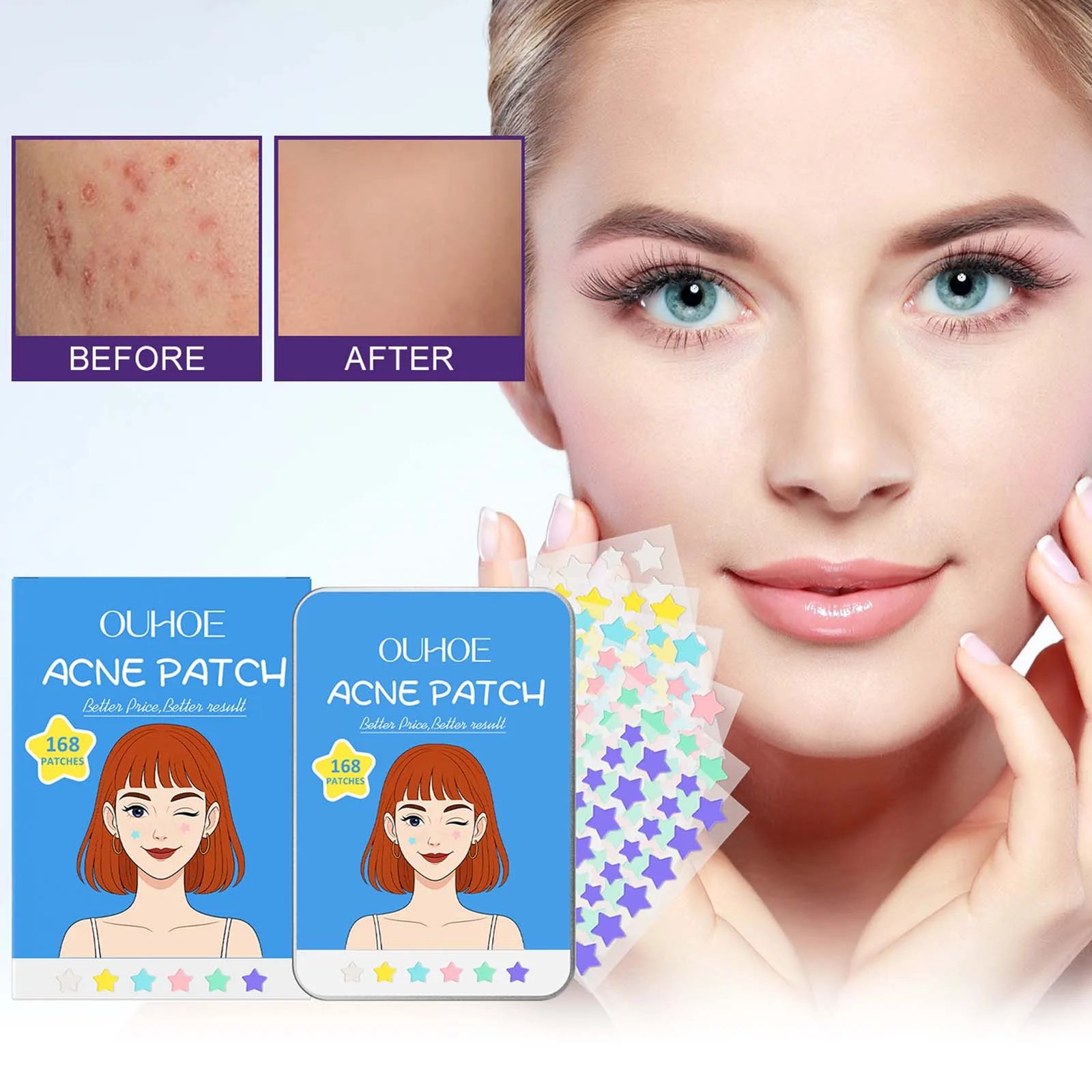 Star Shape Pimple Patches Gentle Clear Invisible Pimple Cover Fade Blemishes Pimple Marks Pimple Healing Sticker Acne Patch